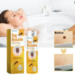 ✨ TAG RECEDE™ Spray tópico para el cuidado de la piel con verrugas